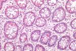 TM9SF4 Antibody in Immunohistochemistry (Paraffin) (IHC (P))