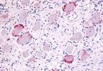 TRPA1 Antibody in Immunohistochemistry (Paraffin) (IHC (P))