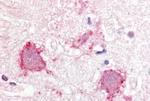 TRPA1 Antibody in Immunohistochemistry (Paraffin) (IHC (P))