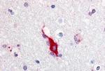 TRPA1 Antibody in Immunohistochemistry (Paraffin) (IHC (P))