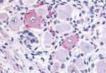 TRPV2 Antibody in Immunohistochemistry (Paraffin) (IHC (P))