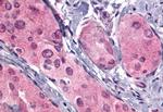 TSH Receptor Antibody in Immunohistochemistry (Paraffin) (IHC (P))