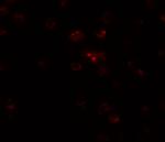 TSHZ2 Polyclonal Antibody