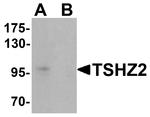 TSHZ2 Antibody in Western Blot (WB)