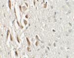 TSHZ3 Polyclonal Antibody