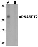 RNASET2 Antibody in Western Blot (WB)