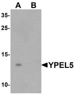 YPEL5 Antibody in Western Blot (WB)