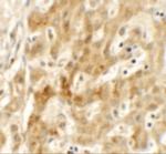 TMEM106B Polyclonal Antibody