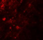 AIG1 Antibody in Immunohistochemistry (IHC)