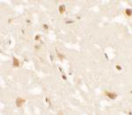 AIG1 Polyclonal Antibody