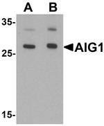 AIG1 Antibody in Western Blot (WB)