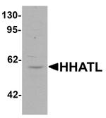 HHATL Antibody in Western Blot (WB)