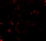 VKORC1 Antibody in Immunohistochemistry (IHC)