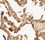 VKORC1 Polyclonal Antibody