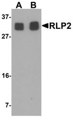 RILPL2 Antibody in Western Blot (WB)