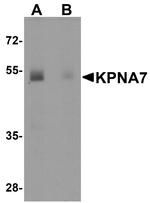 KPNA7 Antibody in Western Blot (WB)