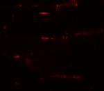 PRC1 Antibody in Immunohistochemistry (IHC)