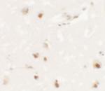 SHANK3 Polyclonal Antibody