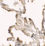 NBS1 Polyclonal Antibody
