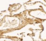 NBS1 Polyclonal Antibody