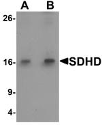 SDHD Antibody in Western Blot (WB)