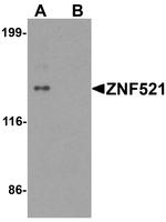 ZNF521 Antibody in Western Blot (WB)