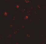 ZNF687 Polyclonal Antibody