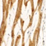 FCHO2 Polyclonal Antibody