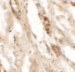 DBX2 Polyclonal Antibody