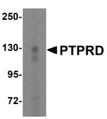 PTPRD Polyclonal Antibody