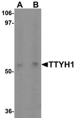 TTYH1 Antibody in Western Blot (WB)