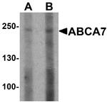 ABCA7 Antibody in Western Blot (WB)