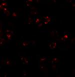 LEMD2 Antibody in Immunocytochemistry (ICC/IF)
