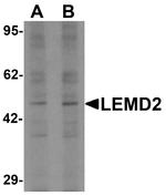 LEMD2 Antibody in Western Blot (WB)