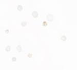 Septin 1 Polyclonal Antibody