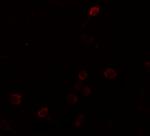 Septin 1 Antibody in Immunocytochemistry (ICC/IF)