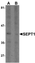 Septin 1 Antibody in Western Blot (WB)