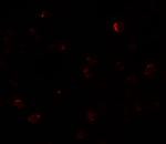 ZBTB40 Polyclonal Antibody