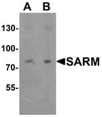 SARM Antibody in Western Blot (WB)