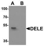 DELE Antibody in Western Blot (WB)
