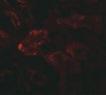 RAB21 Polyclonal Antibody