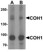 COH1 Antibody in Western Blot (WB)