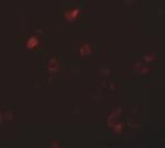 CCDC22 Polyclonal Antibody