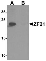 ZFYVE21 Antibody in Western Blot (WB)