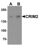 CRIM2 Polyclonal Antibody