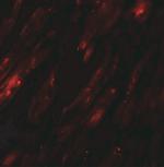 SELK Antibody in Immunohistochemistry (IHC)