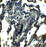 NDFIP1 Polyclonal Antibody