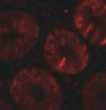 TOX Polyclonal Antibody