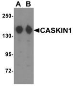 CASKIN1 Polyclonal Antibody