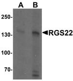 RGS22 Antibody in Western Blot (WB)